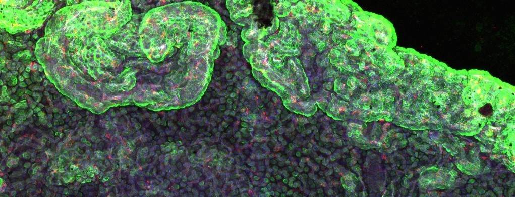 A fluorescent green 3-D image of a choroid plexus cell taken from a microscope