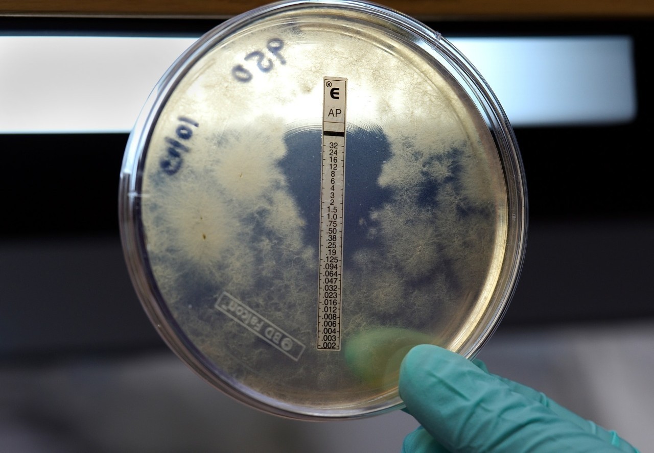 A gloved hand is holding up a Petri dish with bacteria growing inside