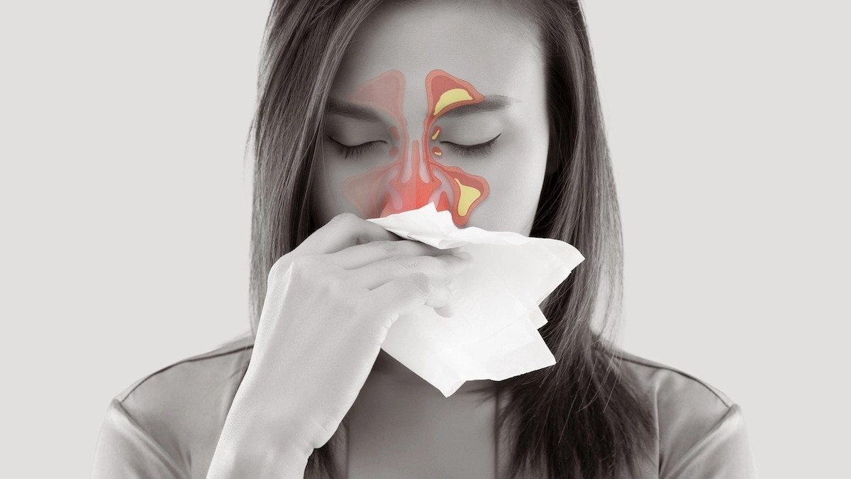 Illustration of woman with inflamed sinuses blowing her nose