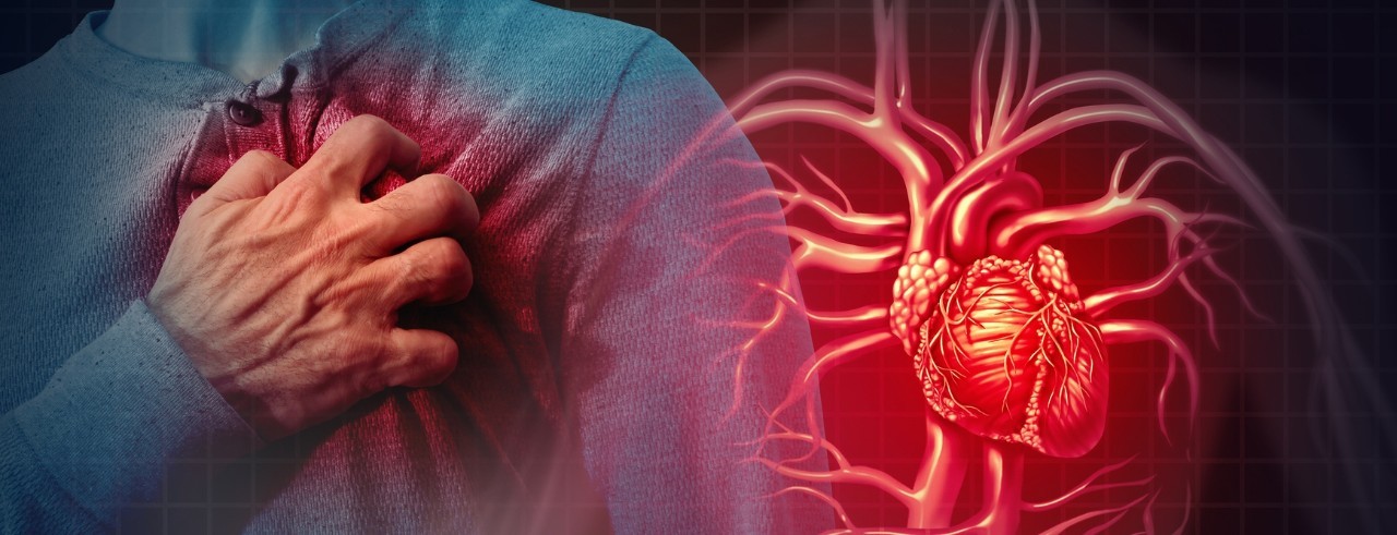 Illustration of person having chest pain from atrial fibrillation