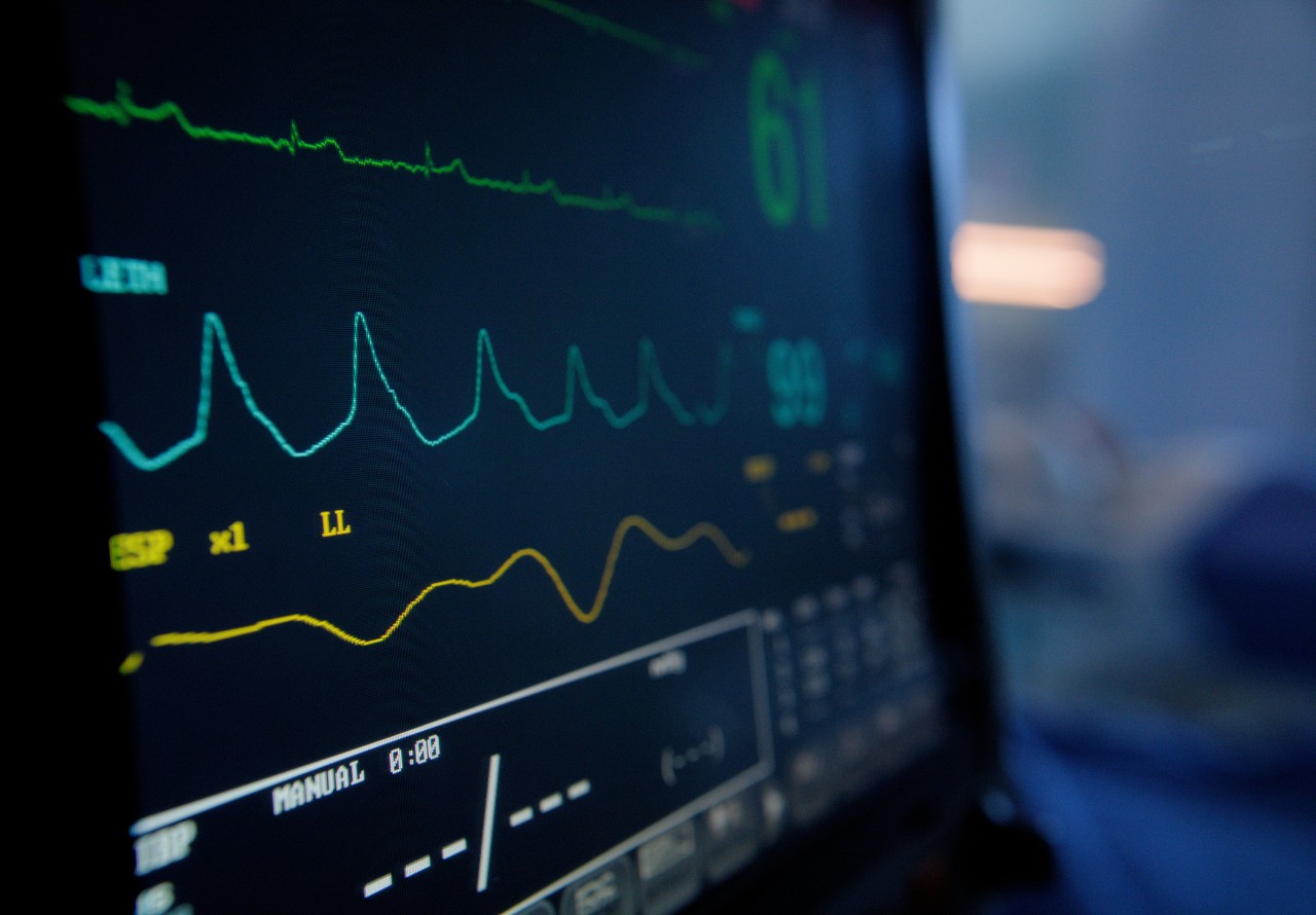 A vital signs monitor in a hospital setting.