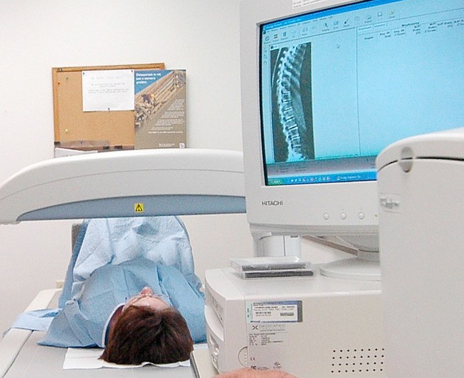 Bone mineral density testing is the only way to tell if you have osteoporosis. 