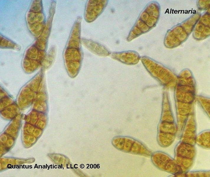 This is a magnified view of alternaria, an airborne fungal spore.
