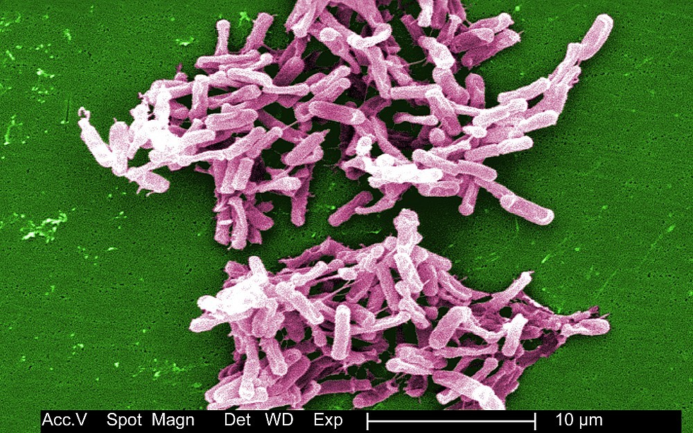 Clostridium difficile, or C. diff, bacterium